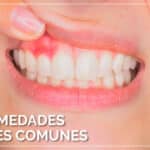 Cuáles son los problemas dentales más comunes en la dentición mixta