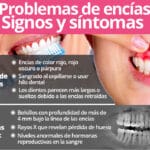 Es normal que las embarazadas experimenten cambios en sus dientes y encías? ¿Cuáles son esos cambios y cómo se pueden manejar